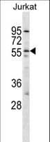 Polyclonal Rabbit anti-Human OX2R / Orexin Receptor 2 Antibody (aa275-304, WB)