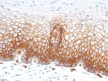 Monoclonal Mouse anti-Human THBD / CD141 / Thrombomodulin Antibody (clone THBD/1591, IHC, IF, WB)