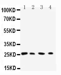 Polyclonal Rabbit anti-Human RAB3C Antibody (aa204-217, WB)