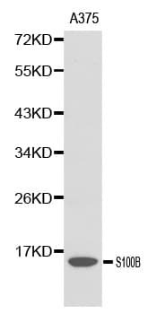 S100B / S100 Beta Antibody
