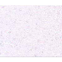 MEOX1 Antibody