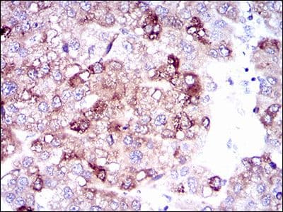 SLC27A5 / BACS Antibody (Amino Acid: 508-570, clone 4B11C10)