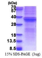 Human TNFRSF6B / DCR3 Protein (Recombinant His)