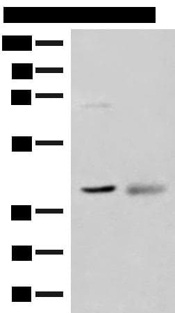 ADH5 Antibody