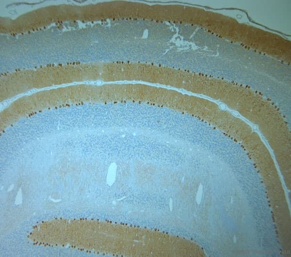 Polyclonal Rabbit anti-Human ITPR1 / IP3 Receptor Type 1 Antibody (aa700-750, IHC)