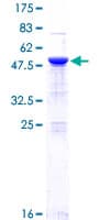 Human RELA / NFKB p65 Protein (Recombinant GST)