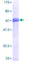 Human SORD / Sorbitol Dehydrogenase Protein (Recombinant GST)