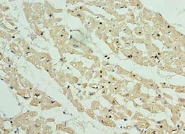ANAPC10 / APC10 Antibody (aa1-185)
