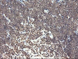Monoclonal Mouse anti-Human PNPO Antibody (clone OTI1G9, IHC, WB)