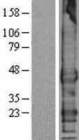 Human TMEFF1 / Tomoregulin 1 Protein (Over-Expression Lysate Myc-DDK (Flag))
