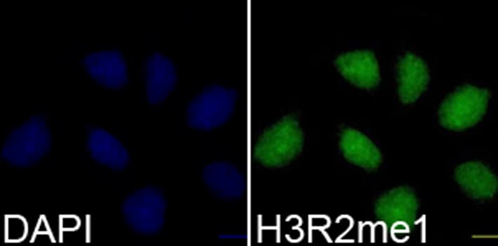 Histone H3 Antibody (Mono-Methyl-Arg2)