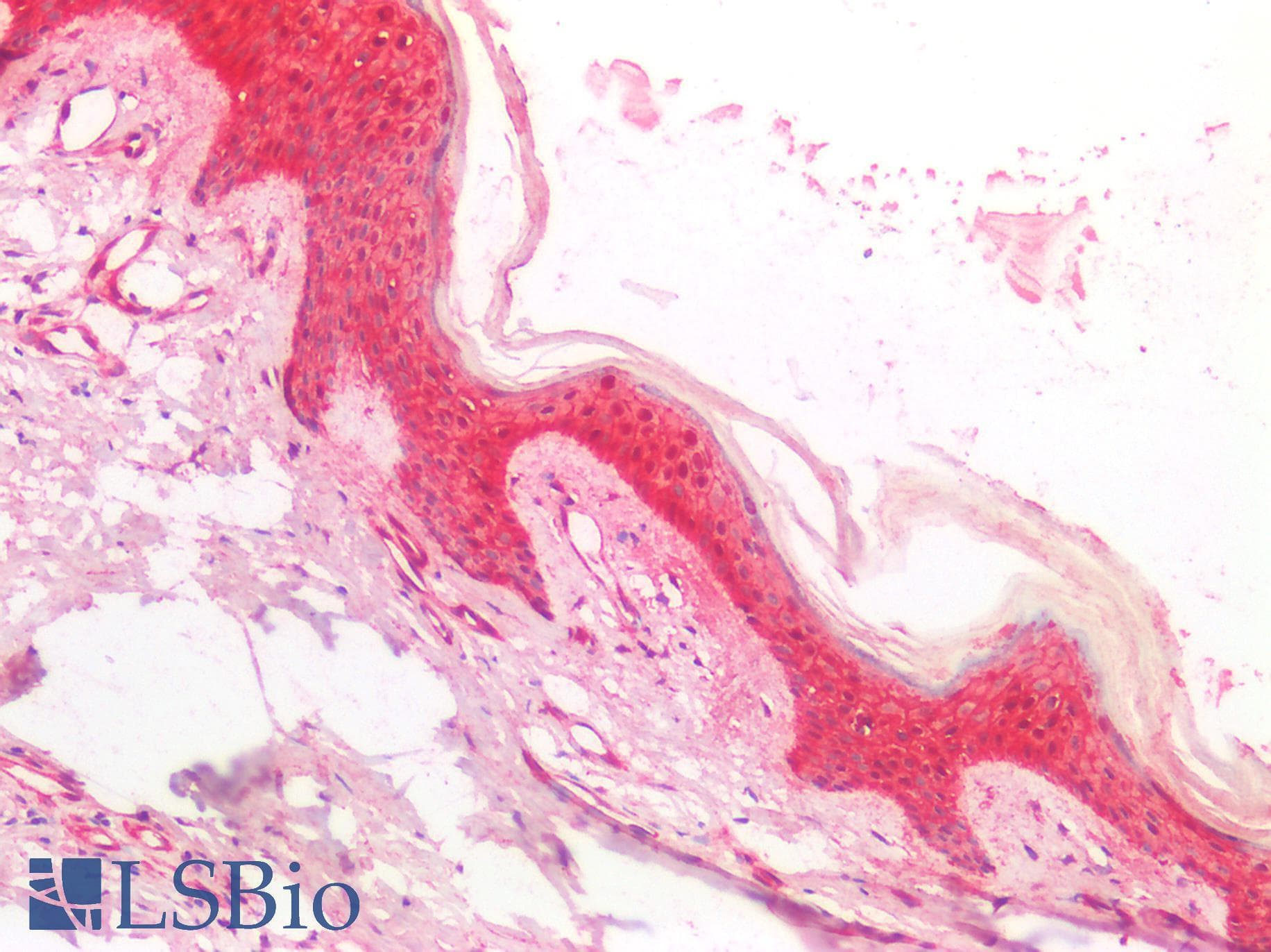 PathPlus™ CTNNB1 / Beta Catenin Antibody