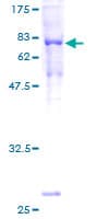 Human TUBA1B / Tubulin Alpha 1B Protein (Recombinant GST)
