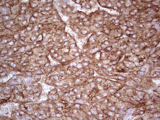 APOE / Apolipoprotein E Antibody (clone OTI3B9)