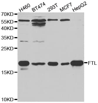 FTL / Ferritin Light Chain Antibody