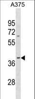 OR13D1 Antibody (aa276-304)