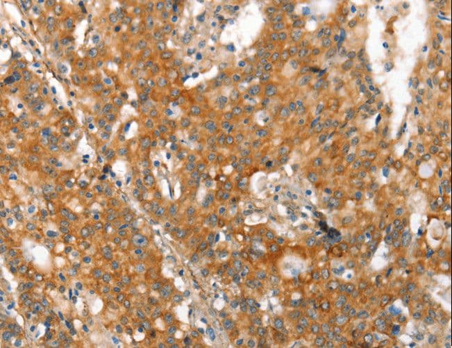 Polyclonal Rabbit anti-Human MMP2 Antibody (IHC)
