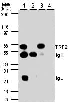 IHC-plus™ TERF2 / TRF2 Antibody