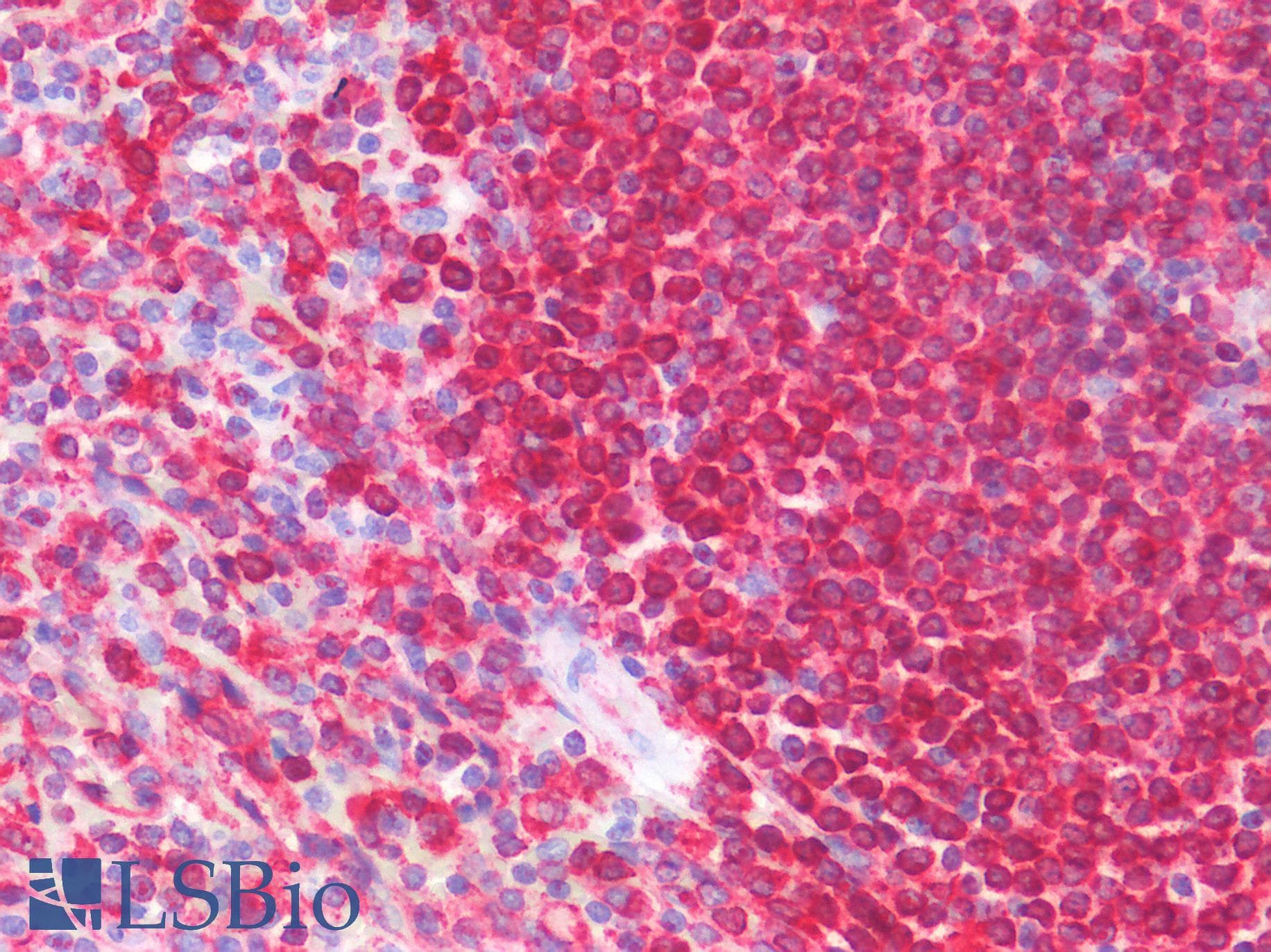 IHC-plus™ Polyclonal Goat anti-Human CD74 / CLIP Antibody (aa159-171, IHC, WB)