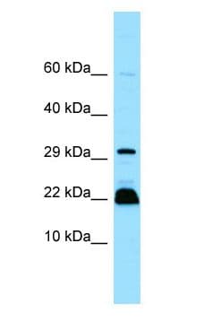 Polyclonal Rabbit anti-Human MYLPF Antibody (C-Terminus, WB)