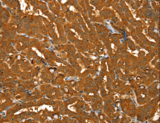 Polyclonal Rabbit anti-Human PYGM Antibody (IHC, WB)