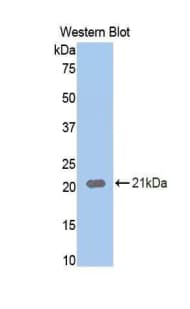 NRP1 / Neuropilin 1 Antibody (aa431-583)
