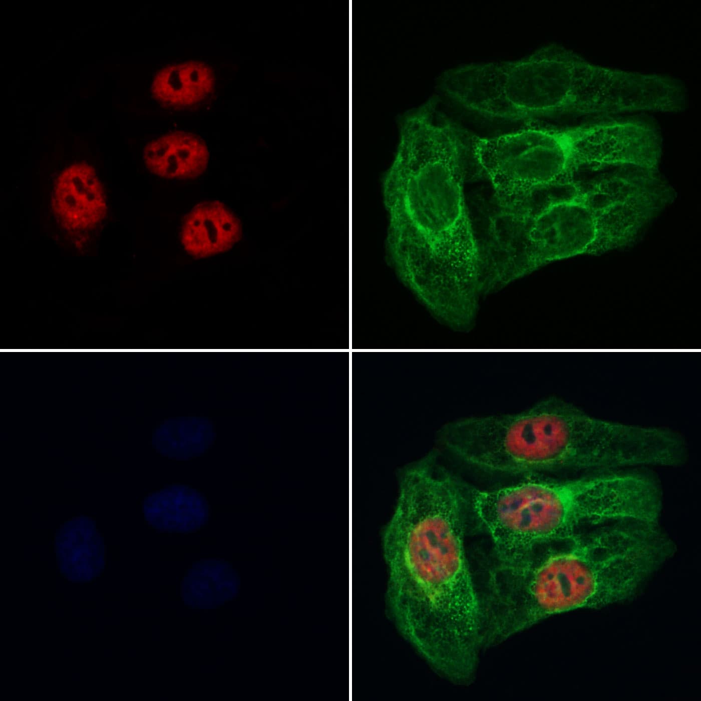 RABL3 Antibody