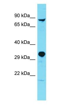 PARPBP / C12orf48 Antibody (aa175-224)