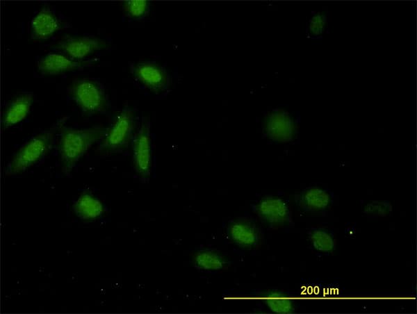 CASP9 / Caspase 9 Antibody (clone 3B8-4G2)