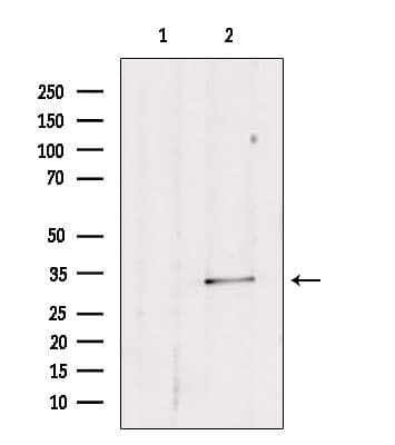SULT1E1 / Sulfotransferase 1E1 Antibody