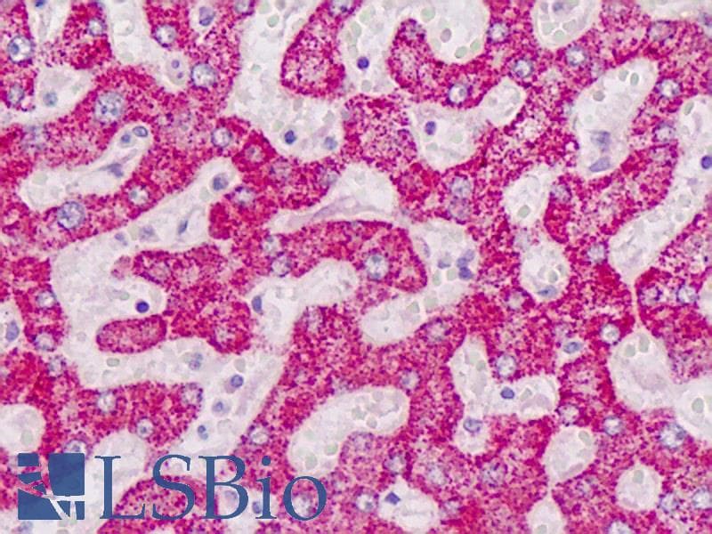 IHC-plus™ ALDH6A1 Antibody (aa367-396)