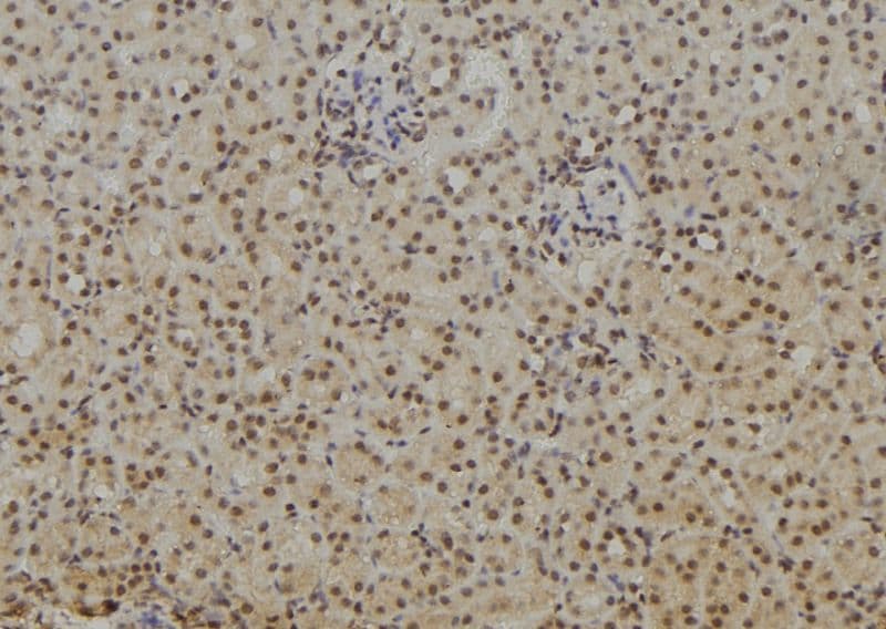 NFKB1 / NF-Kappa-B Antibody