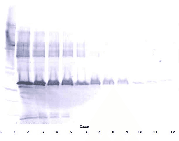 Polyclonal Rabbit anti-Human APOE / Apolipoprotein E Antibody (Biotin, WB)