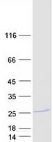 Human C6orf66 Protein (Recombinant Myc-DDK (Flag))