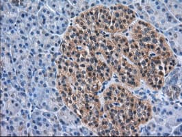 ACAT2 Antibody (clone OTI1B7)