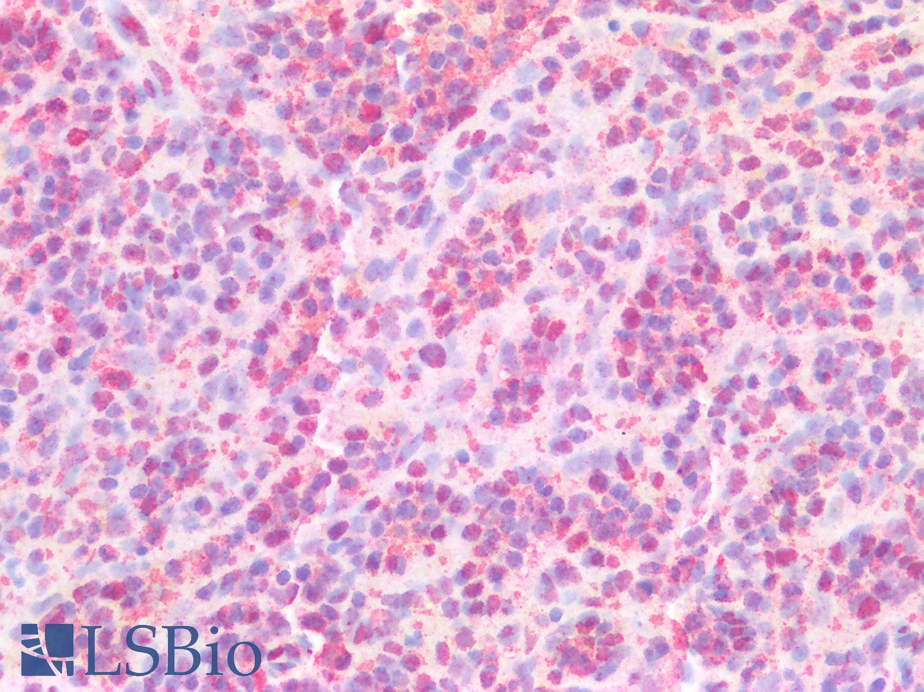 PathPlus™ GAPDH Antibody (aa30-44)