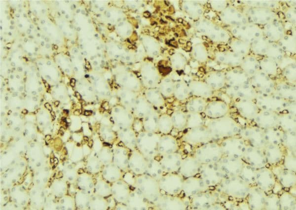 PARD6A / PAR6 Antibody