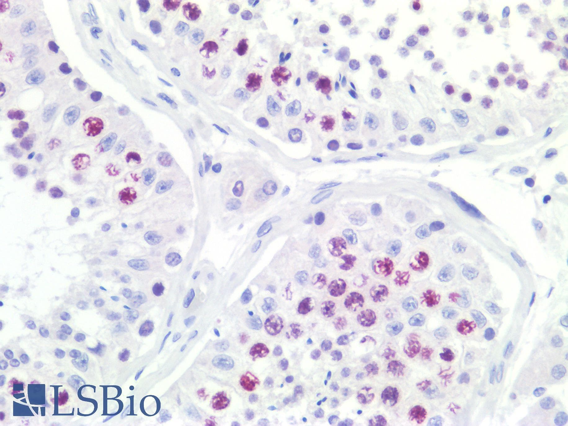 IHC-plus™ TOP2A / Topoisomerase II Alpha Antibody