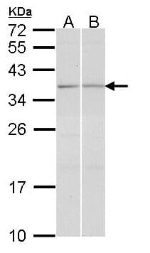 TGIF2 Antibody (aa161-237)