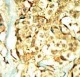 TNIK Antibody (aa1-30)