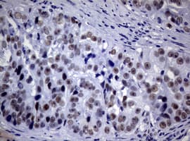 NBN / Nibrin Antibody (clone OTI6D10)