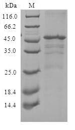 Human CXCR3 Protein (Recombinant 10His, N-terminus)