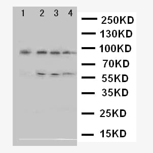 ADAM17 / TACE Antibody (aa806-824)