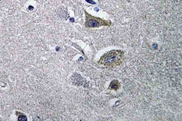Polyclonal Rabbit anti-Human NDUFV2 Antibody (Pro52, IHC, WB)
