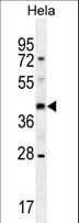 Polyclonal Rabbit anti-Human OR10H4 Antibody (aa282-311, WB)