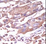 CAMK2A / CaMKII Alpha Antibody (aa446-478)