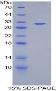 Rat IKBIP Protein (Recombinant His-T7)
