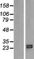 ARL15 Protein (Over-Expression Lysate Myc-DDK (Flag))