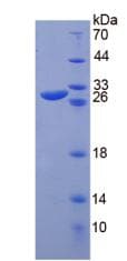 Rat CHI3L1 / YKL-40 Protein (Recombinant His-T7)