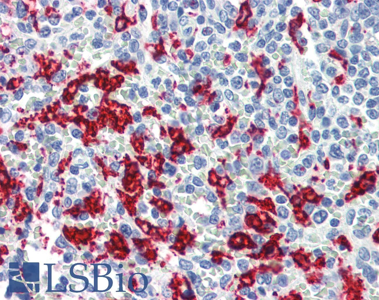 IHC-plus™ HMOX1 / HO-1 Antibody (clone 5F12-B10)